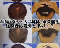 AGA薄毛治療×ヒゲ(身体)永久脱毛経験者は意外と多い！？